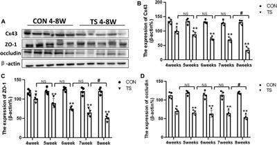 Choroidal circulation disturbance is an initial factor in outer retinal degeneration in rats under simulated weightlessness